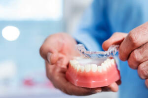 12 Unsichtbare Zahnschienen Ablauf Behandlung