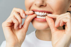 14 Unsichtbare Zahnschienen tragen Vorteile